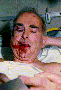 Revisionist author Professor Robert Faurisson is severely injured in a nearly fatal attack on September 16, 1989.  Three assailants sprayed a stinging gas into his face, punched him until he fell to the ground. They proceeded to savagely kick him in the face and chest. Faurisson, who was 60 years old at the time, suffered a broken jaw and severe head injuries. Physicians operated for four and a half hours to repair his jaw and treat a broken rib and badly swollen face.