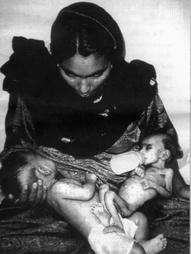 "Use my picture if it will help" said this mother.  The children are twins, the bottle-fed child is a girl who died the day after this photograph was taken by UNICEF in Islamabad, Pakistan.  Her brother was breastfed and thrived.   The mother was incorrectly told she could not breastfeed both children. This horrific picture demonstrates the risk of artificial infant feeding, particularly where water supplies are unsafe.  The expense of formula can lead to parents over-diluting it to make it last longer or using unsuitable milk powders or animal milks.  In all countries breastfeeding provides immunity against infections.  Despite these risks the baby food industry aggressively markets breastmilk substitutes encouraging mothers and health workers to favour artifical infant feeding over breastfeeding.  Such tactics break marketing standards adopted by the World Health Assembly. Nestl, the world's largest food company, is found to be responsible for more violations than any other company and is the target of an international boycott.